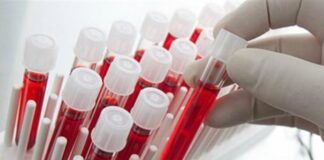 Νέο τεστ αίματος