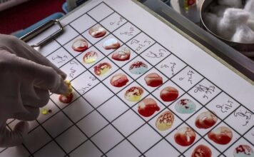 Έρχεται το πρώτο τεστ αίματος για τη διάγνωση της έλλειψης ύπνου τεστ αίματος